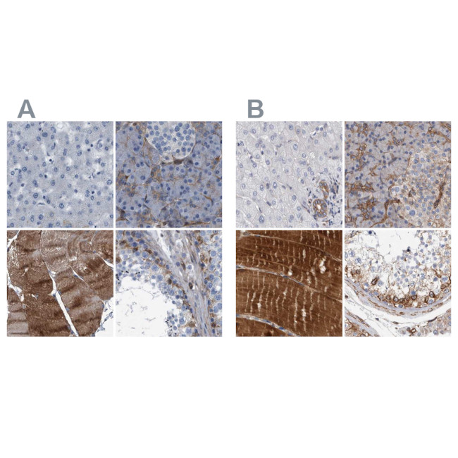 Plectin Antibody in Immunohistochemistry (IHC)