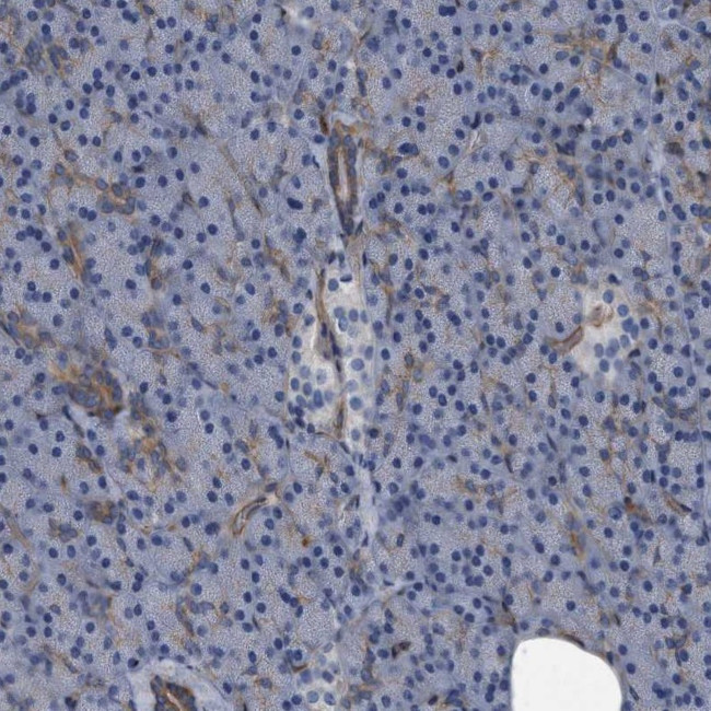 Plectin Antibody in Immunohistochemistry (IHC)