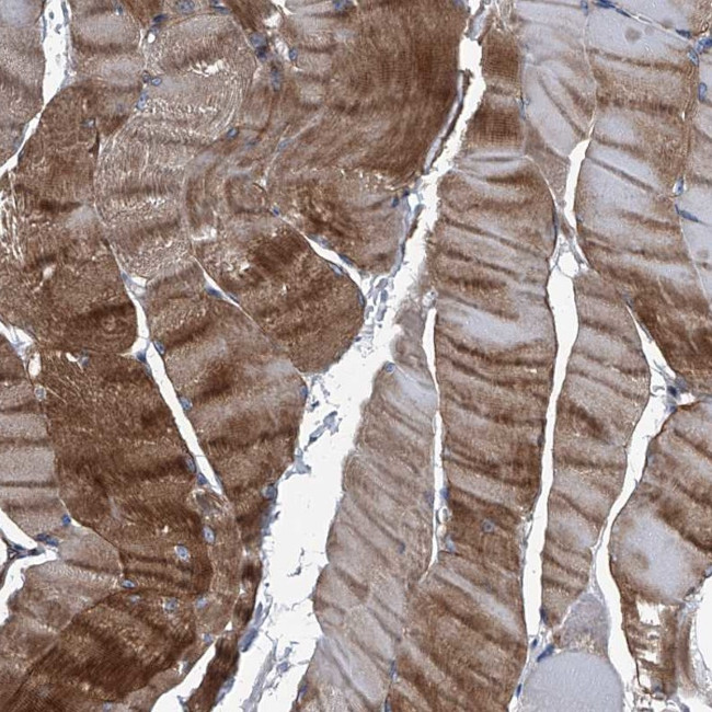 Plectin Antibody in Immunohistochemistry (IHC)