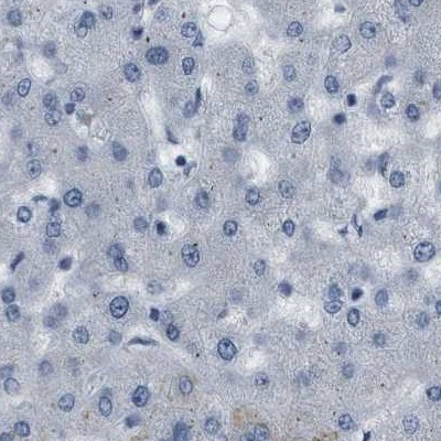 Plectin Antibody in Immunohistochemistry (IHC)