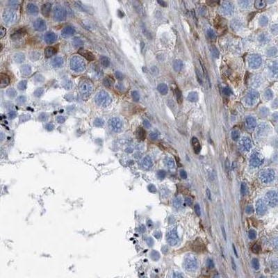 Plectin Antibody in Immunohistochemistry (IHC)