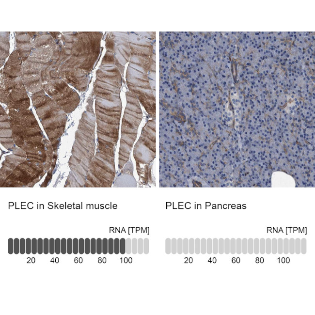 Plectin Antibody