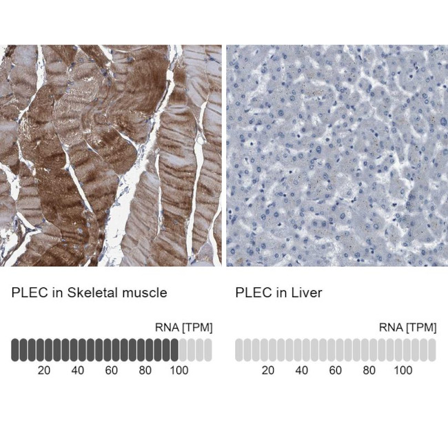 Plectin Antibody