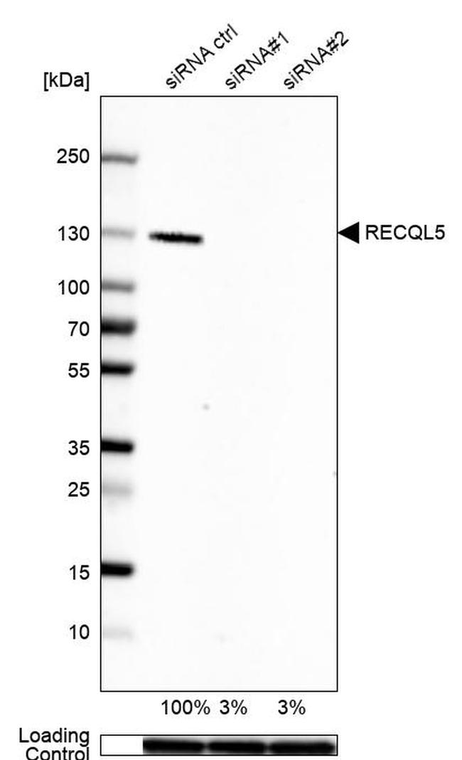 RECQL5 Antibody in Western Blot (WB)