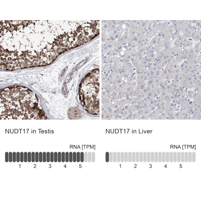 NUDT17 Antibody in Immunohistochemistry (IHC)