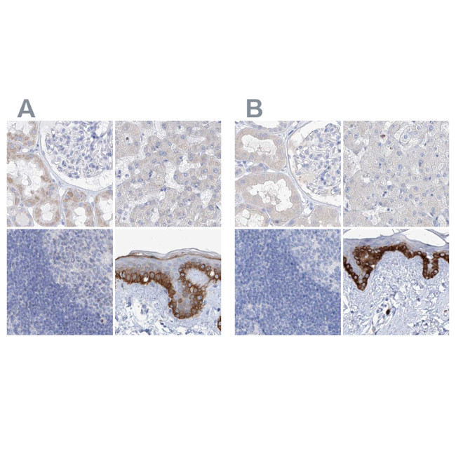 FRS3 Antibody in Immunohistochemistry (IHC)