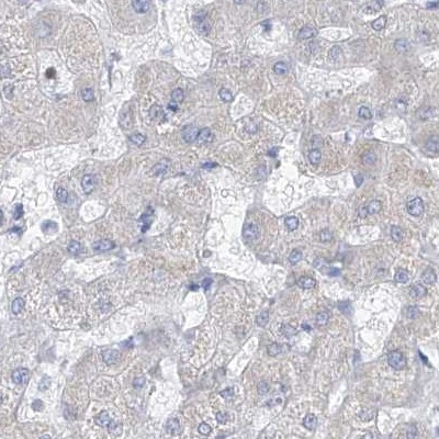 FRS3 Antibody in Immunohistochemistry (IHC)