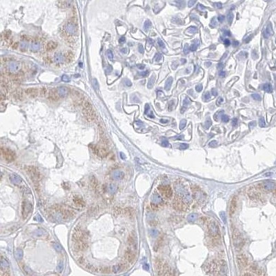 FRS3 Antibody in Immunohistochemistry (IHC)