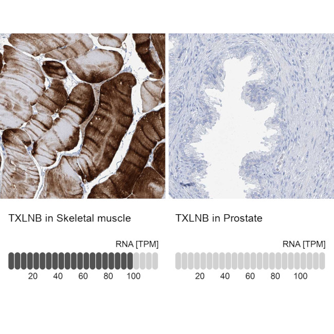 TXLNB Antibody in Immunohistochemistry (IHC)