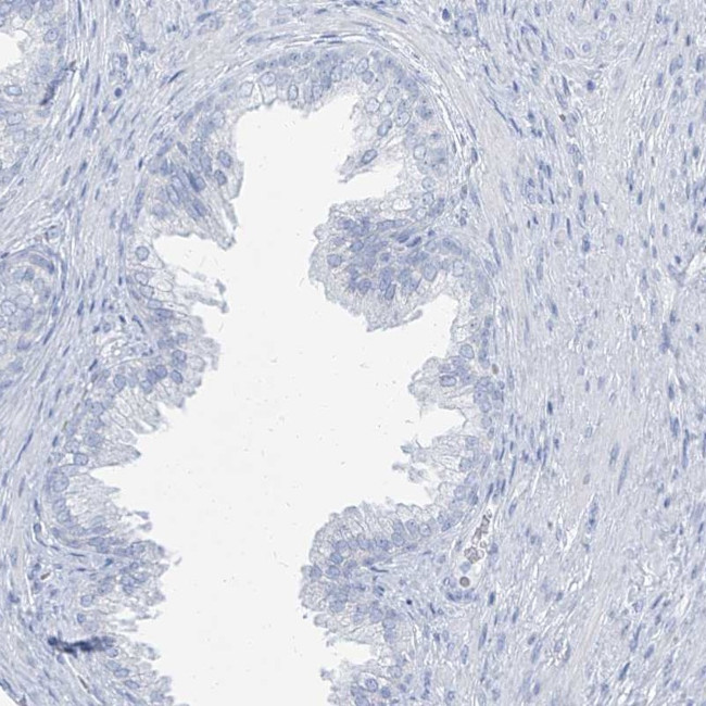 TXLNB Antibody in Immunohistochemistry (IHC)