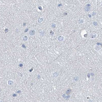 TXLNB Antibody in Immunohistochemistry (IHC)