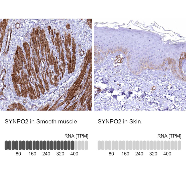 SYNPO2 Antibody in Immunohistochemistry (IHC)