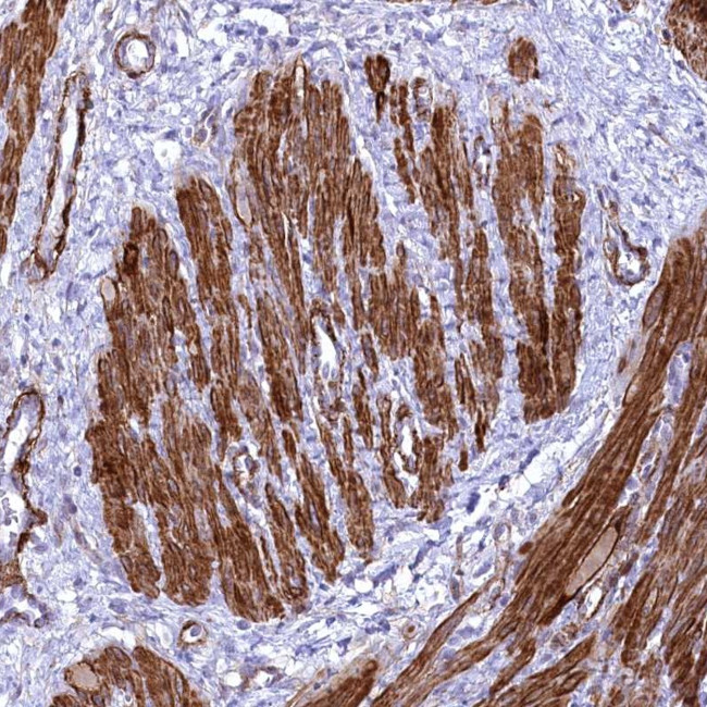 SYNPO2 Antibody in Immunohistochemistry (IHC)