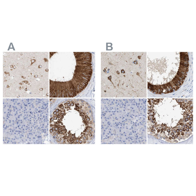 RCN2 Antibody in Immunohistochemistry (IHC)