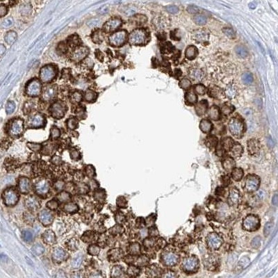 RCN2 Antibody in Immunohistochemistry (IHC)