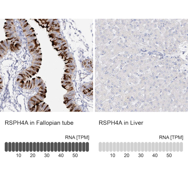 RSPH4A Antibody in Immunohistochemistry (IHC)