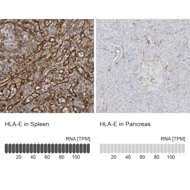 HLA-E Antibody in Immunohistochemistry (IHC)