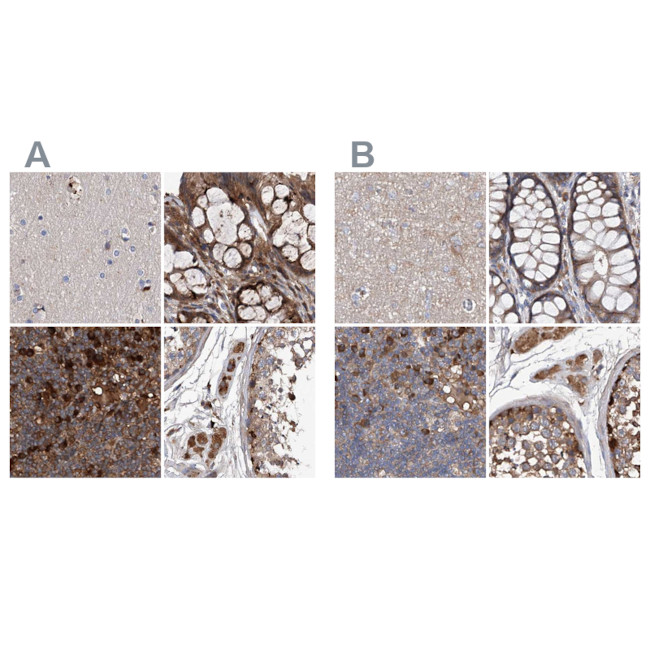 ASCC3 Antibody in Immunohistochemistry (IHC)