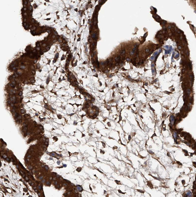 ASCC3 Antibody in Immunohistochemistry (IHC)