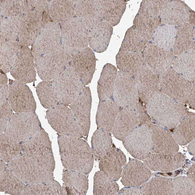 ASCC3 Antibody in Immunohistochemistry (IHC)