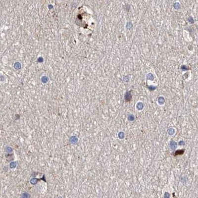 ASCC3 Antibody in Immunohistochemistry (IHC)