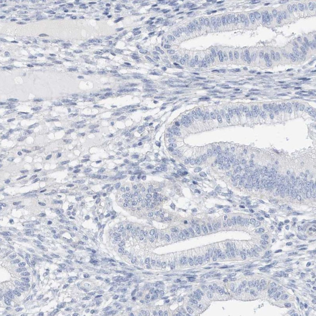 SPOCD1 Antibody in Immunohistochemistry (IHC)