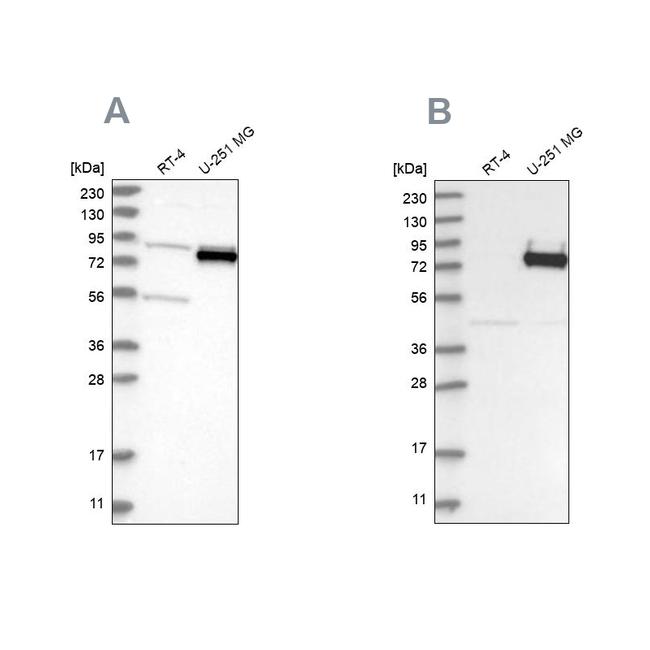 COLGALT2 Antibody in Western Blot (WB)