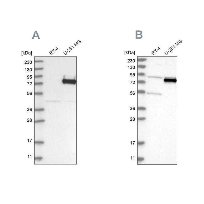 COLGALT2 Antibody in Western Blot (WB)