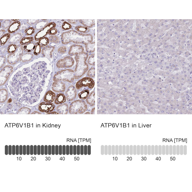 ATP6V1B1 Antibody