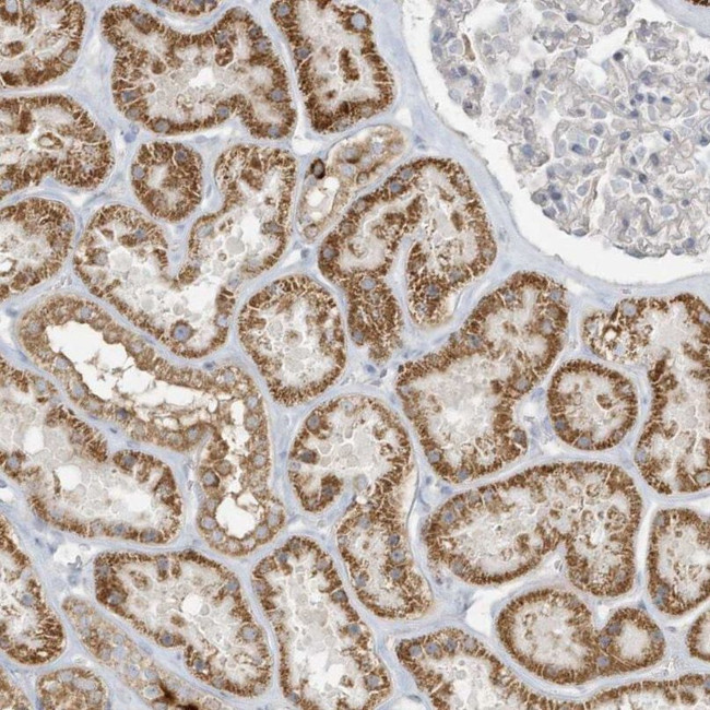 UHRF1BP1 Antibody in Immunohistochemistry (IHC)