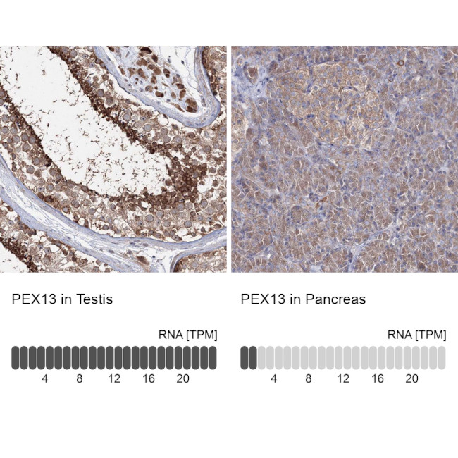 PEX13 Antibody in Immunohistochemistry (IHC)