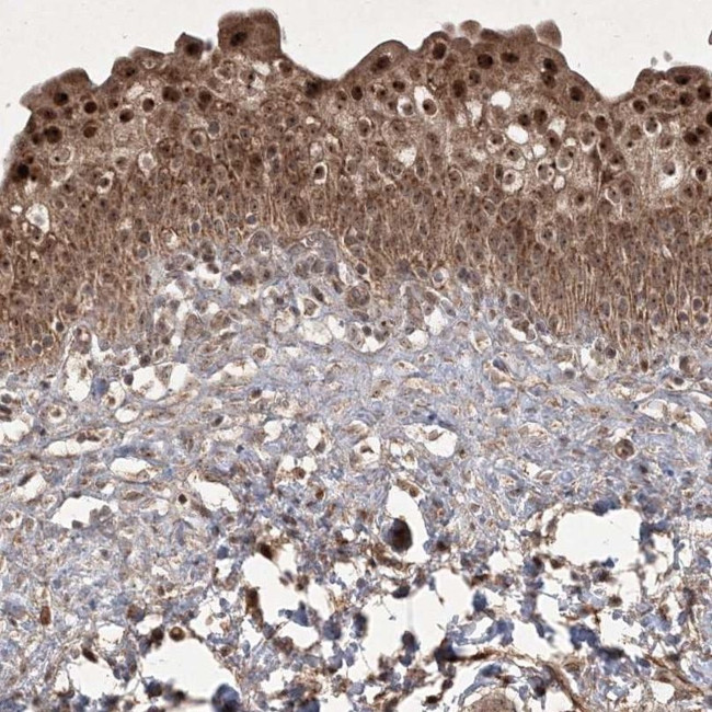 PLEKHM2 Antibody in Immunohistochemistry (IHC)