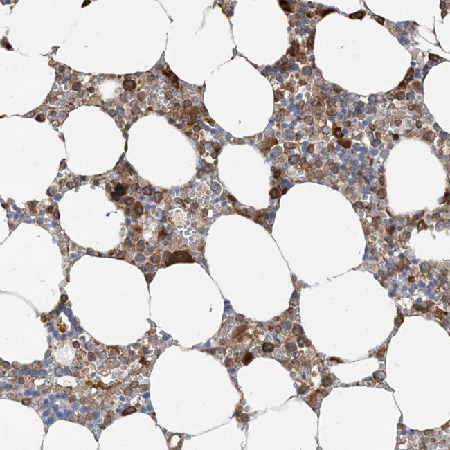 SRP72 Antibody in Immunohistochemistry (IHC)