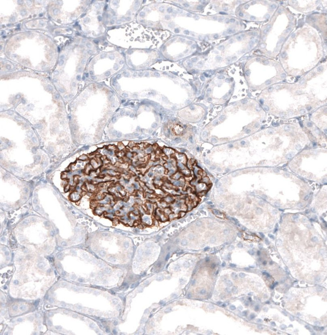 SYNPO Antibody in Immunohistochemistry (IHC)