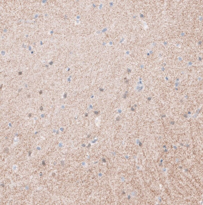 SYNPO Antibody in Immunohistochemistry (IHC)