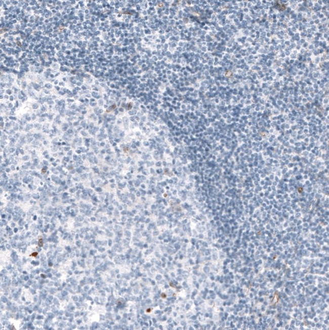 SYNPO Antibody in Immunohistochemistry (IHC)