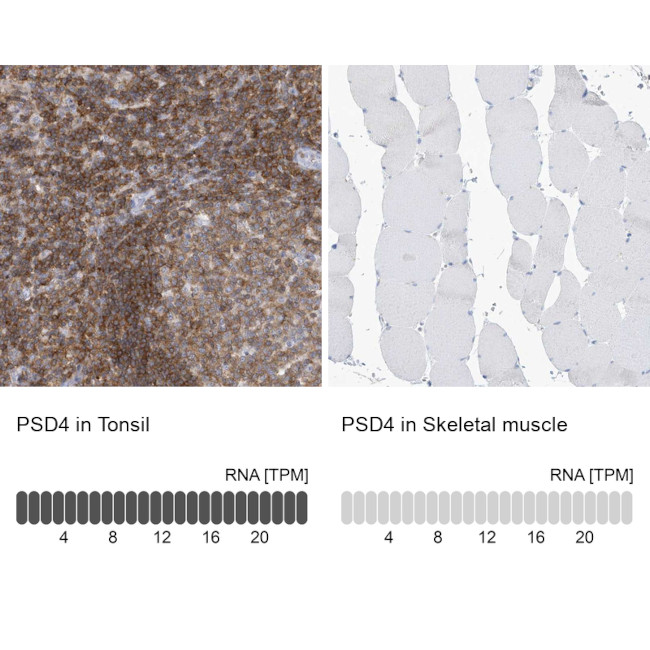 PSD4 Antibody in Immunohistochemistry (IHC)