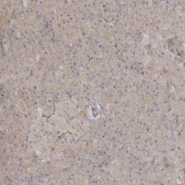 C13orf7 Antibody in Immunohistochemistry (IHC)