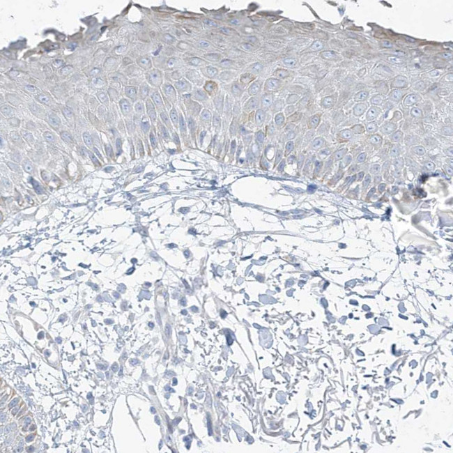 XIRP2 Antibody in Immunohistochemistry (IHC)