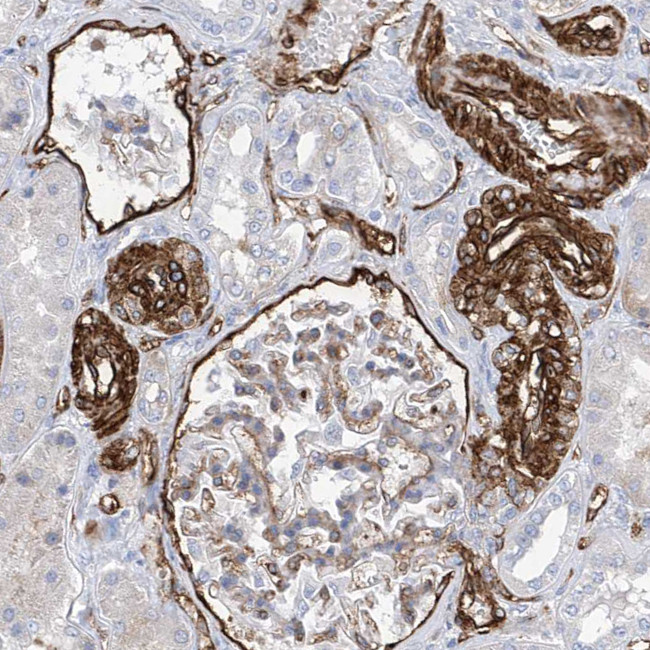 UBTD1 Antibody in Immunohistochemistry (IHC)