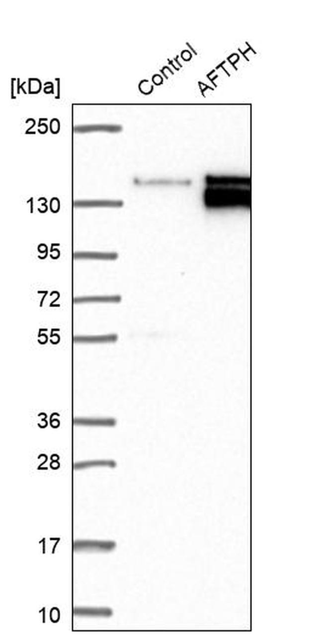 AFTPH Antibody in Western Blot (WB)