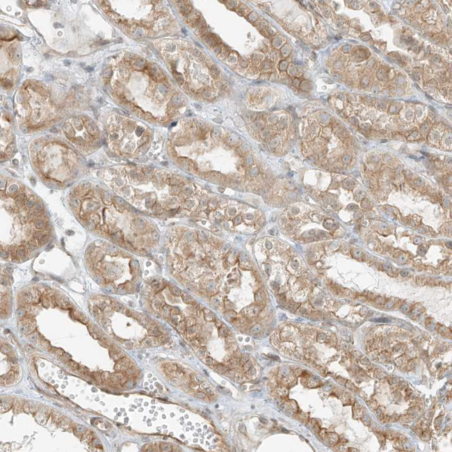 LANCL1 Antibody in Immunohistochemistry (IHC)