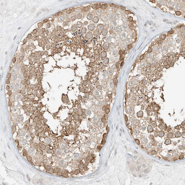 LANCL1 Antibody in Immunohistochemistry (IHC)