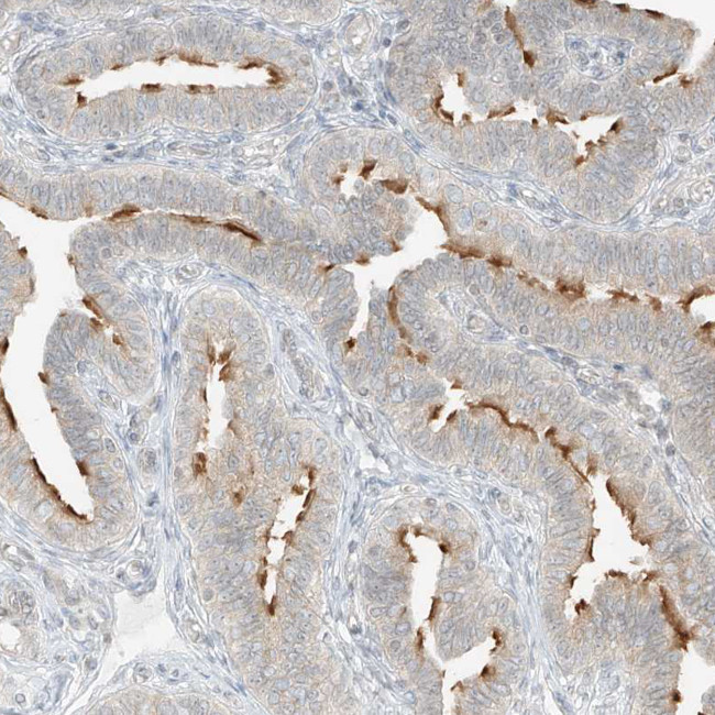 LANCL1 Antibody in Immunohistochemistry (IHC)