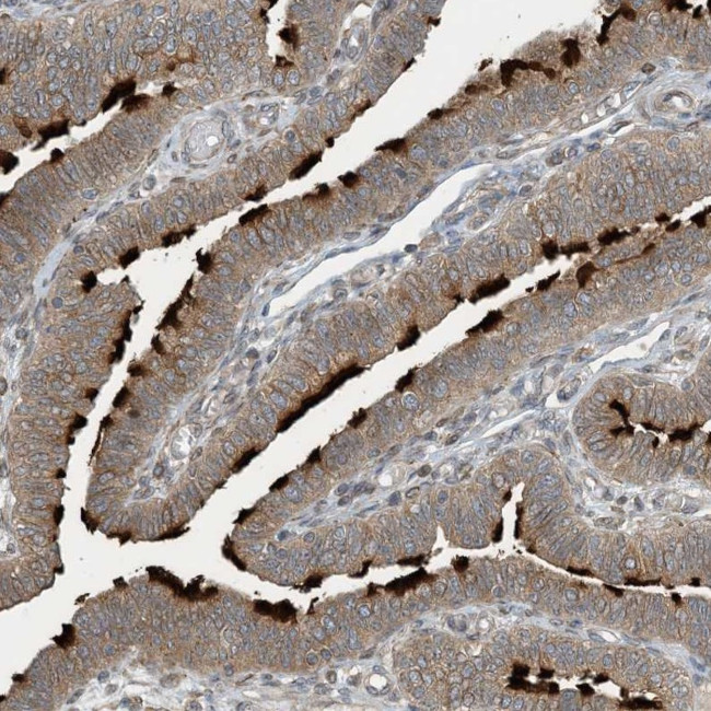 ZBTB3 Antibody in Immunohistochemistry (IHC)