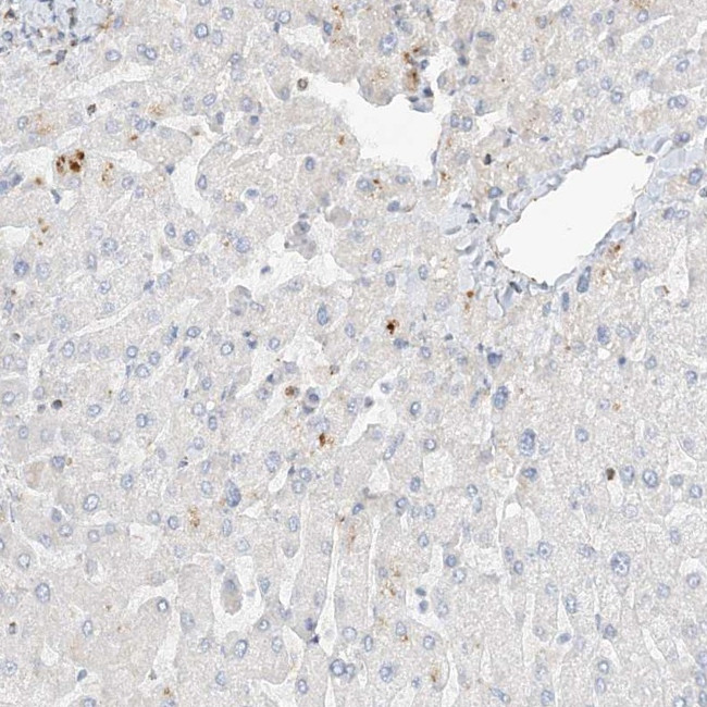 SLC25A12 Antibody in Immunohistochemistry (IHC)