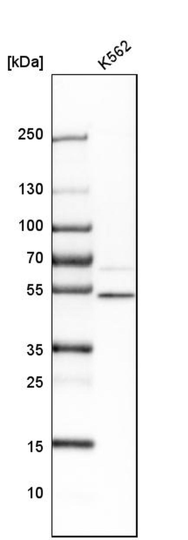 UBR3 Antibody in Western Blot (WB)