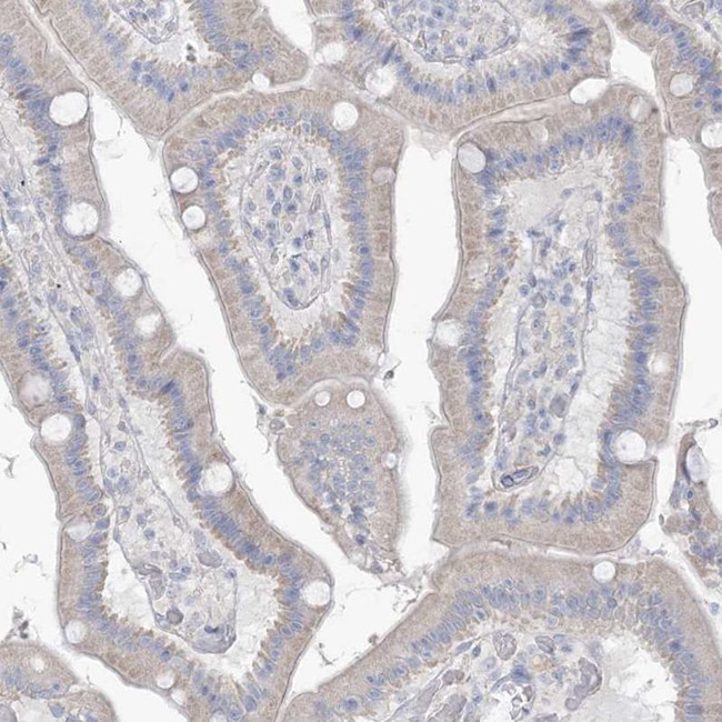 MTHFD2L Antibody in Immunohistochemistry (IHC)