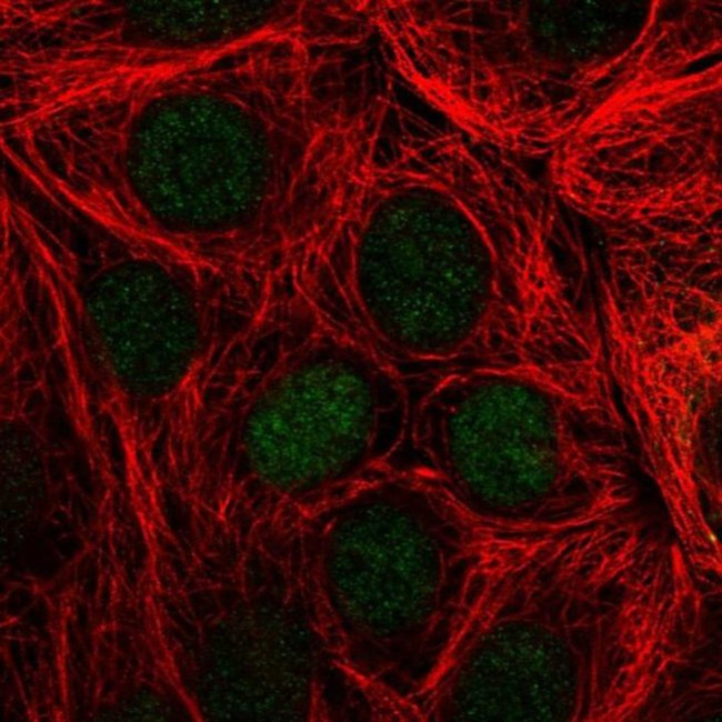 TFF3 Antibody in Immunocytochemistry (ICC/IF)