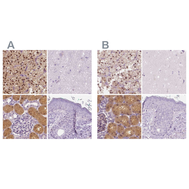 GALM Antibody in Immunohistochemistry (IHC)